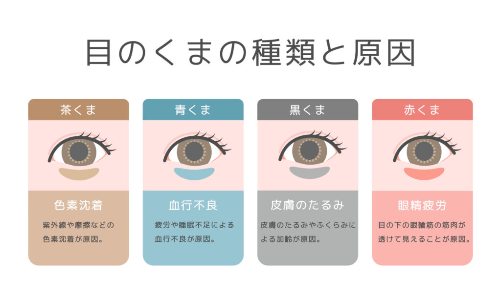  1-3. クマの4種類の見分け方を一目で比較する早見表