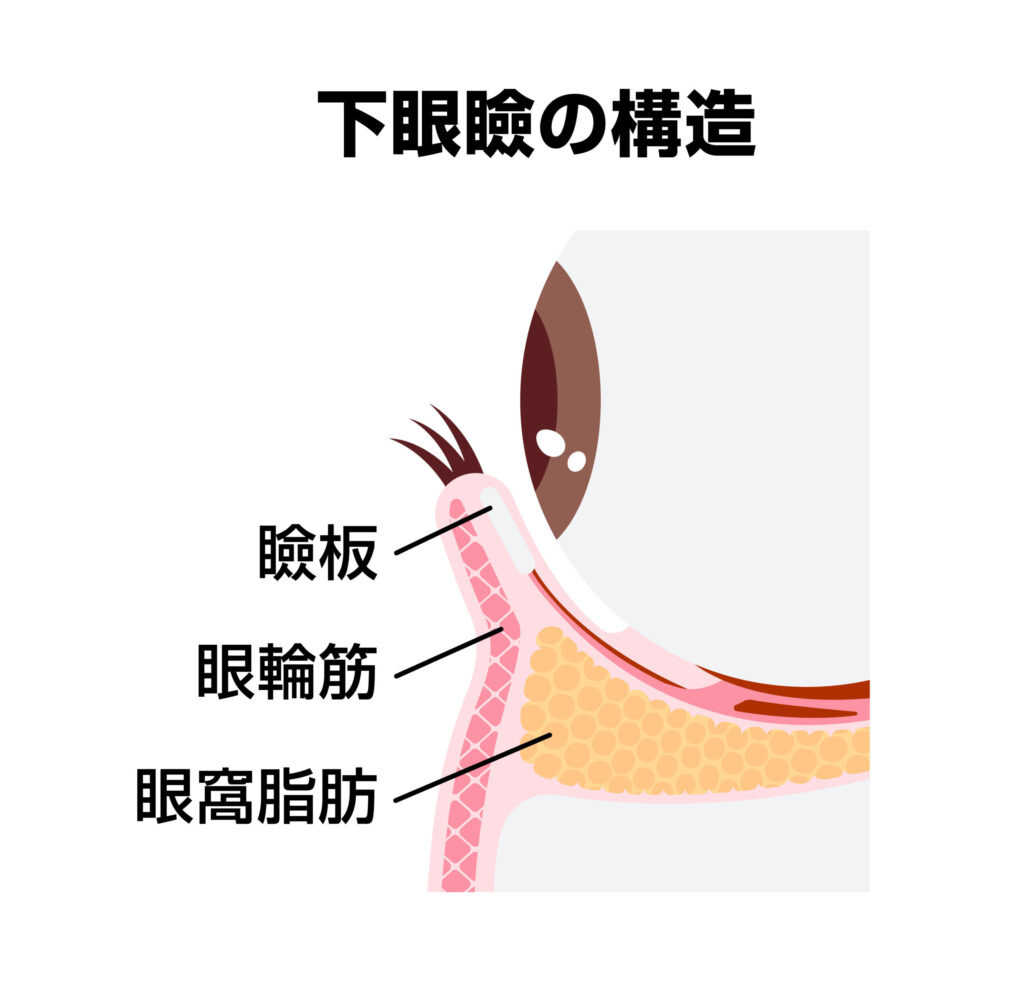 1-1. 目の下の膨らみはなぜ生まれるのか