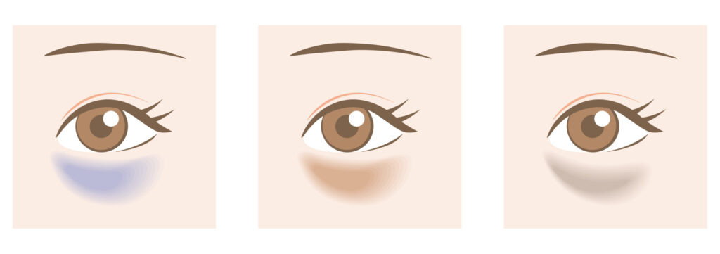 1-1. 黒クマは「色」ではなく「影」が原因