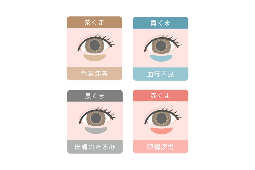 第1章 あなたのクマはどのタイプ？原因と見分け方チェック