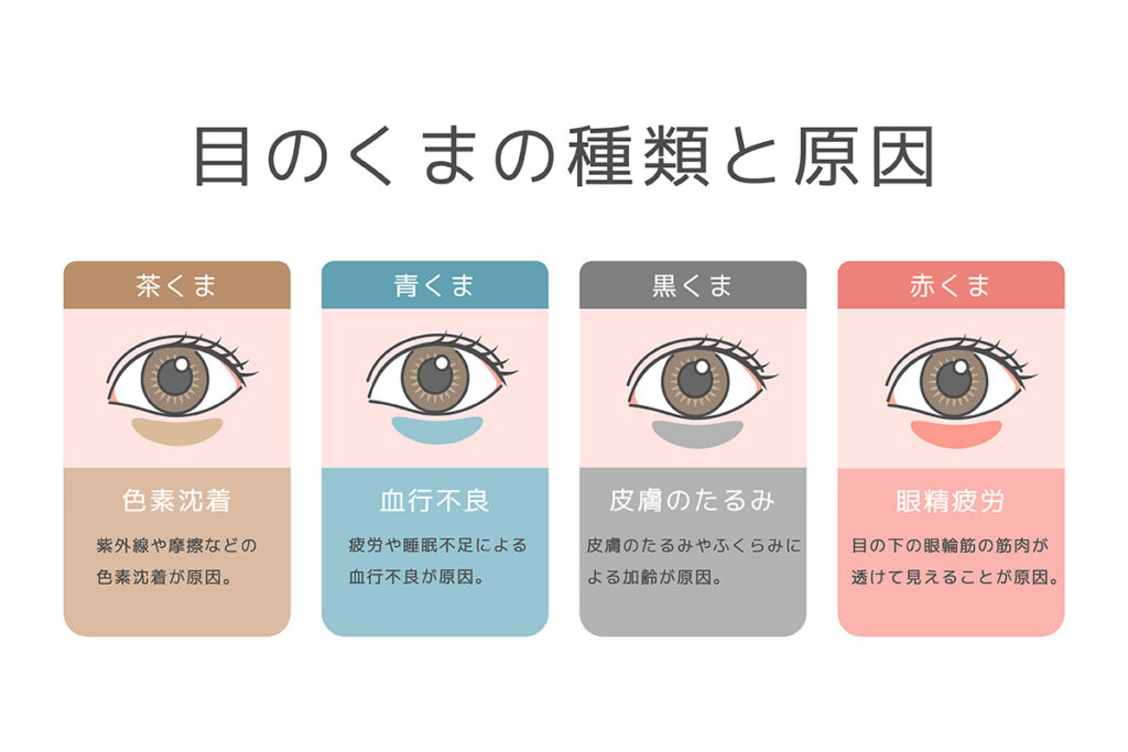 1章. 生まれつき消えない「クマ」の正体とは？クマの種類を見分ける方法