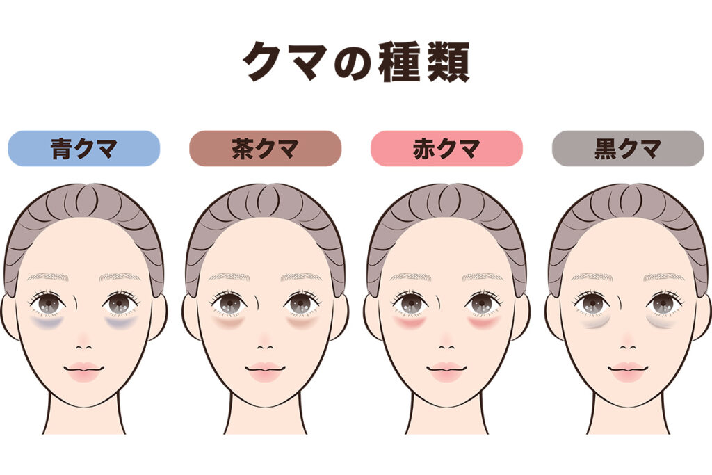 1-1. 紫クマは「青クマ」と「赤クマ」が混ざった混合サイン