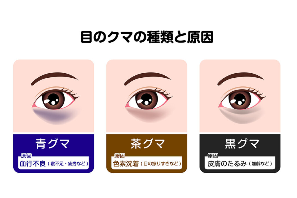 第2章 クマの種類別選ぶべきアイクリームとは