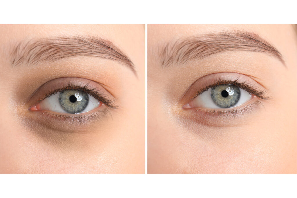 第4章 自力では直せない重度の黒クマ