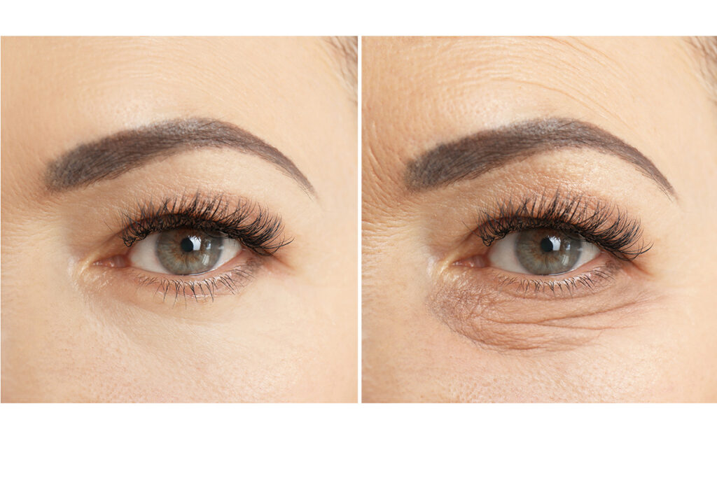 第6章 目の下のクマ改善にまつわるよくある質問