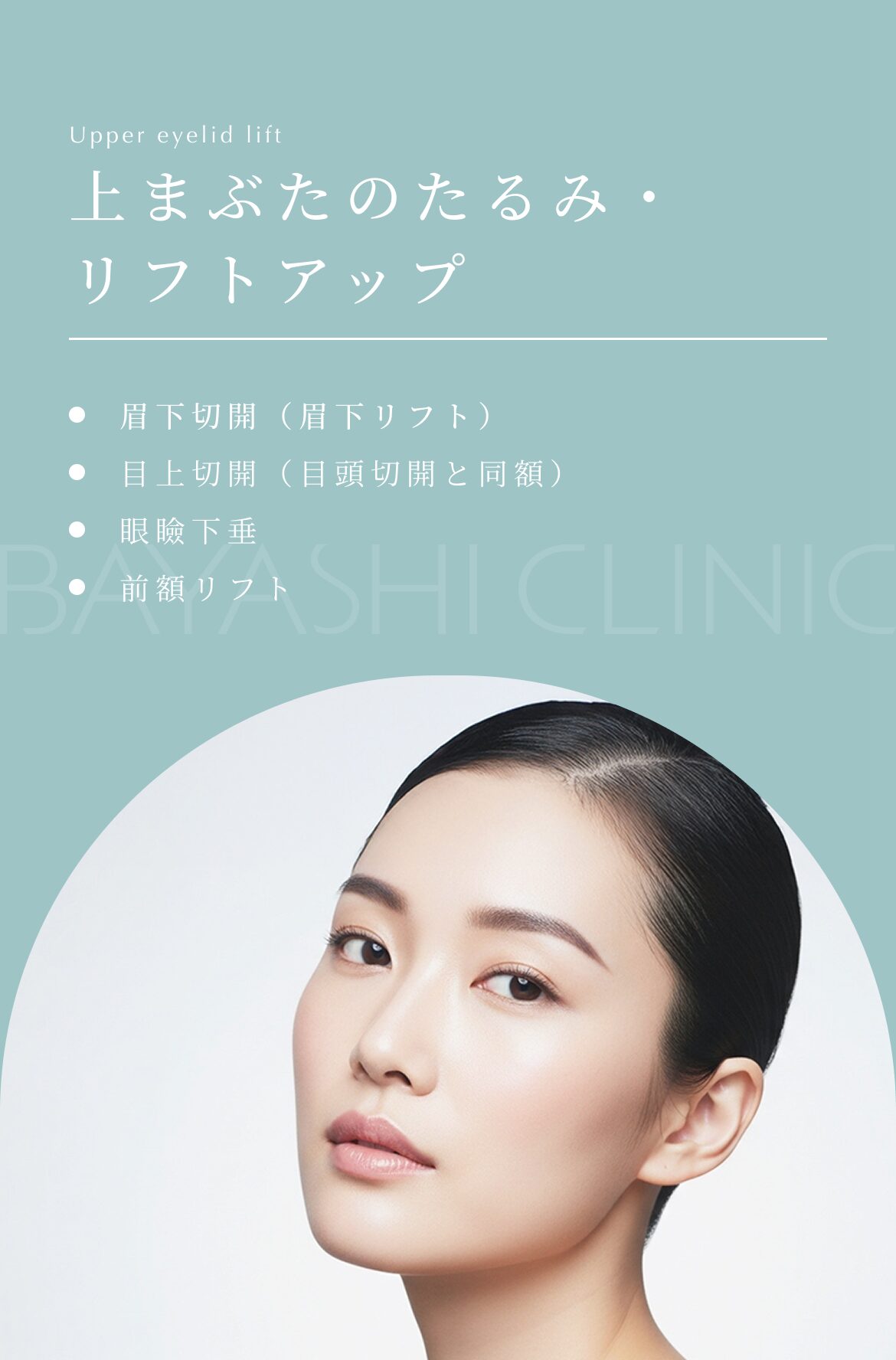 上まぶたのたるみ・リフトアップ